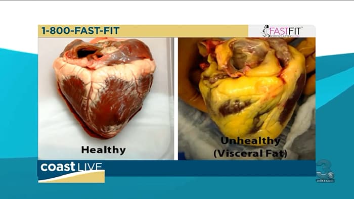 Is Visceral Fat Dangerous?