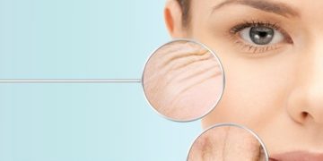 PRP Injections for wrinkles?