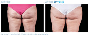 Emtone PIC Ba card female buttock 003 ENUS100