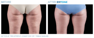 Emtone PIC Ba card female buttock 004 ENUS100