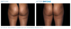 Emtone PIC Ba card female buttock 006 ENUS100