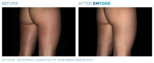 Emtone PIC Ba card female buttock 007 ENUS100