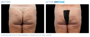 Emtone PIC Ba card female buttock 011 EN100