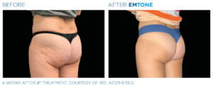 Emtone PIC Ba card female buttock 014 EN100