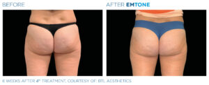 Emtone PIC Ba card female buttock 015 EN100